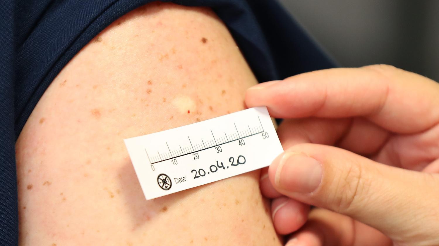 BCG: vacina contra tuberculose tem estoque limitado