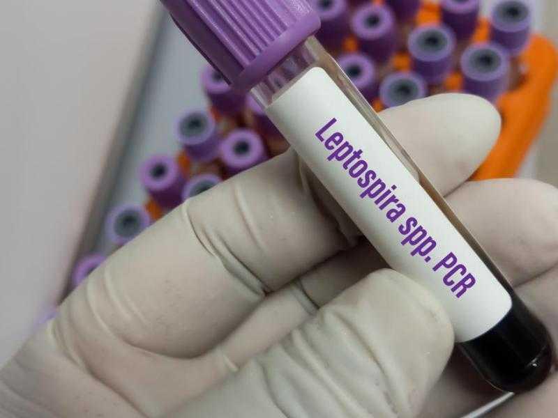Saúde pede atenção quanto a possíveis casos de leptospirose