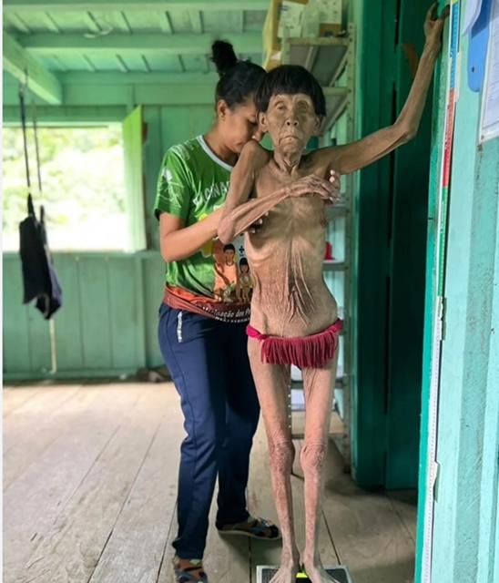 YANOMAMIS CONTINUAM ABANDONADOS E MORTES AUMENTARAM EM 50%