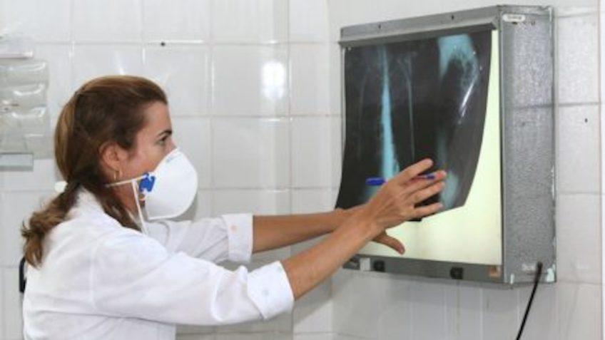 Brasil não atinge meta da OMS para reduzir tuberculose.