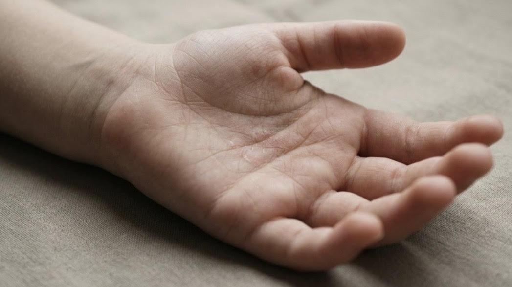 Ministério Público denuncia mulher por torturar e queimar a própria filha com uma colher quente